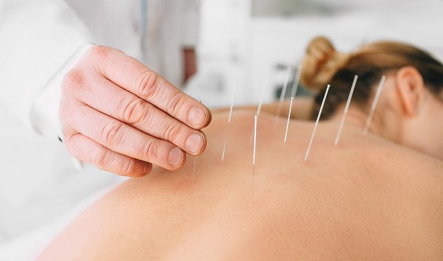 Tibbdə ağrıkəsicilərə alternativ olan iynəbatırma – Akupunktura /Birinci yazı