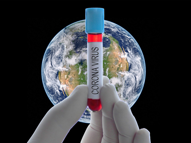 Dünyada koronavirusa yoluxanların sayı 216 milyonu ötüb
