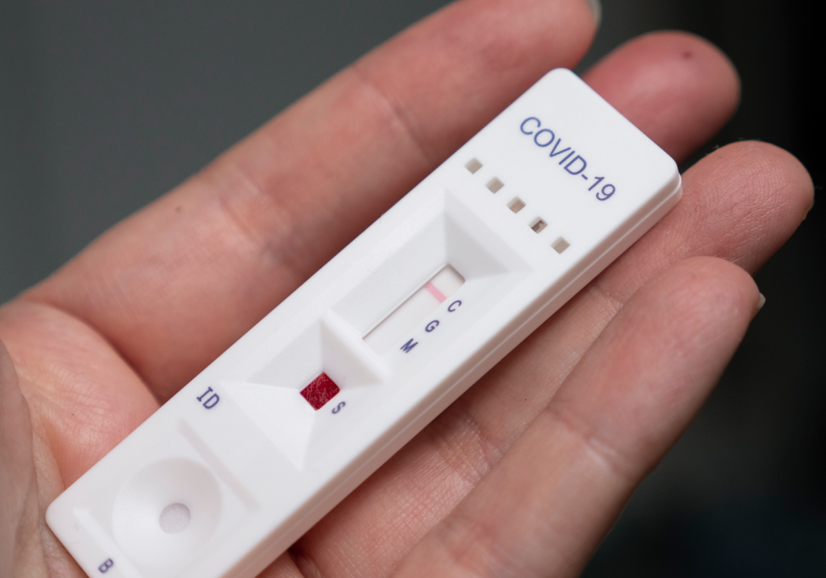 Koronavirus ştamlarının müəyyənləşdirilməsi üçün sürətli test sistemləri hazırlanıb