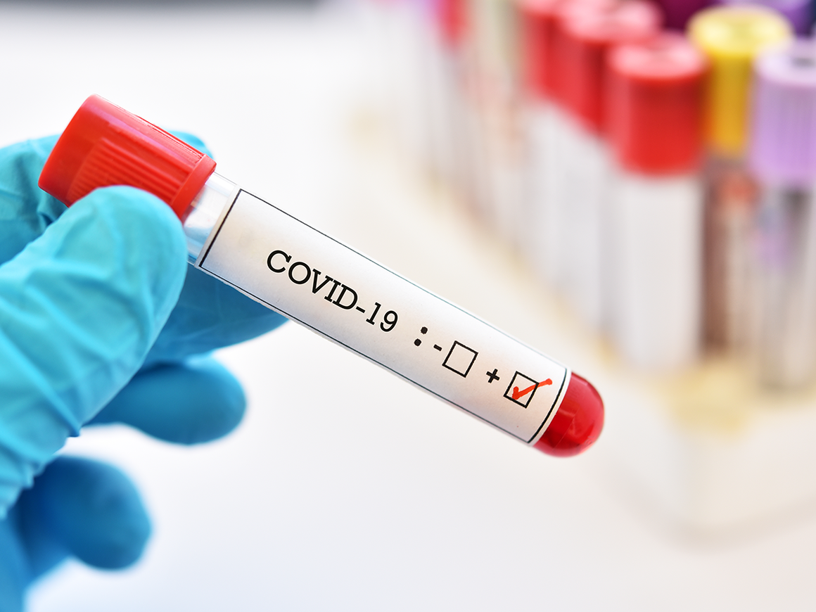 Son sutkada koronavirusdan ölənlərin sayı azalıb  