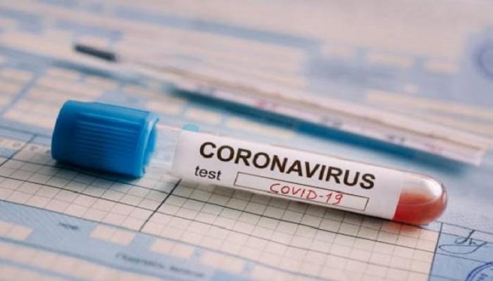 Daha 1 876 nəfər koronavirusa yoluxub