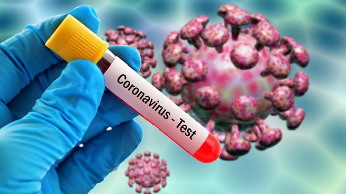 Son sutkada COVID-19-a 582 yoluxma qeydə alınıb