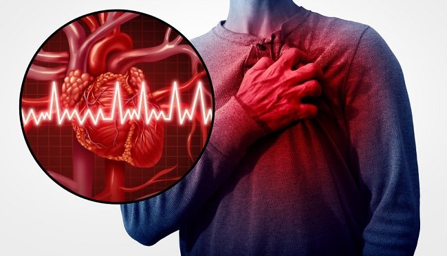 Qayğılar infarkt riskini 13 dəfə artırır. Məsləhət nədir?