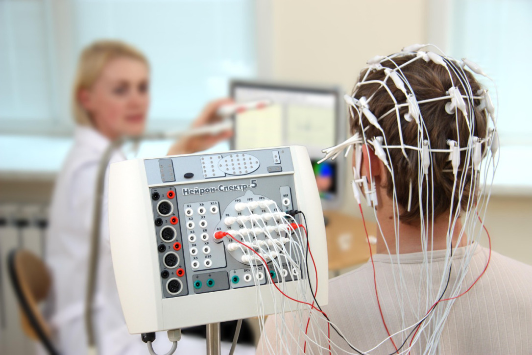 Bu müayinə metodu epileptik xəstəliyin diaqnozunda əsas və həlledici rol oynayır  
