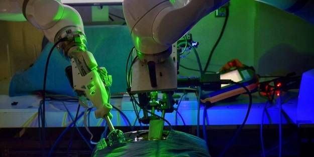 ABŞ-da ilk: Robot insan köməyi olmadan əməliyyat həyata keçirdi