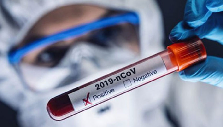 Daha 2 749 nəfərdə koronavirus aşkarlanıb