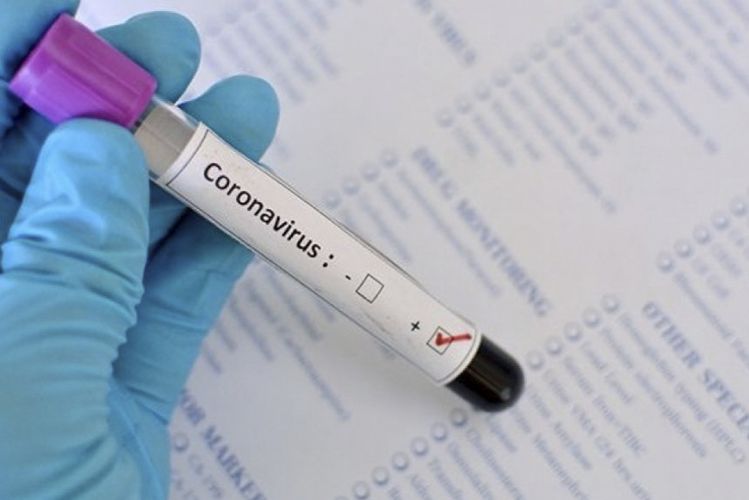 Son sutkada koronavirusa yoluxanların sayı AZALDI