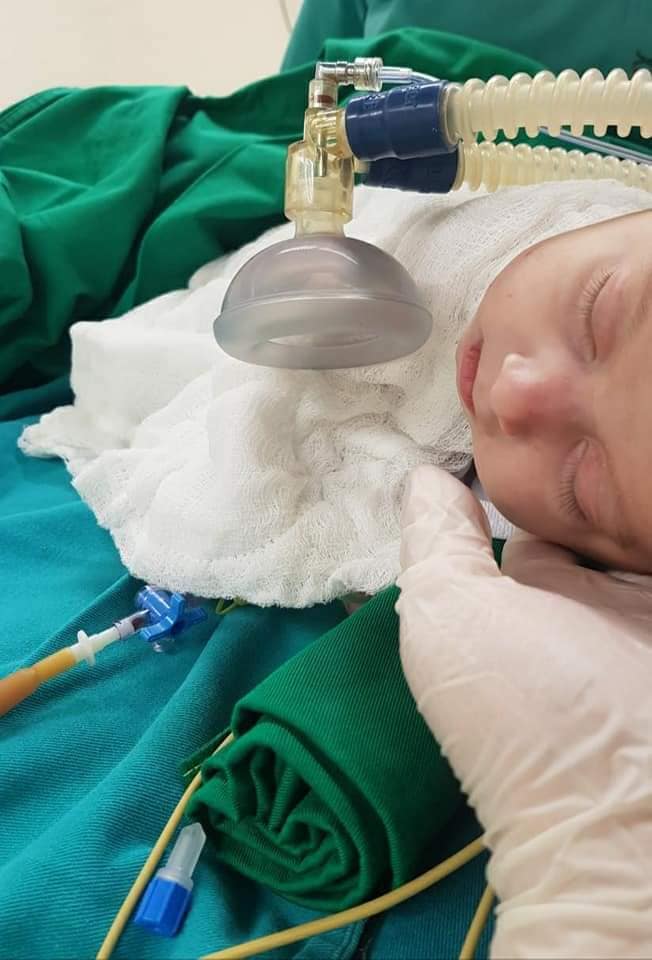 Nəfəs borusunda yerkökü parçası qalan azyaşlı əməliyyat edilib - Mərkəzi Klinika