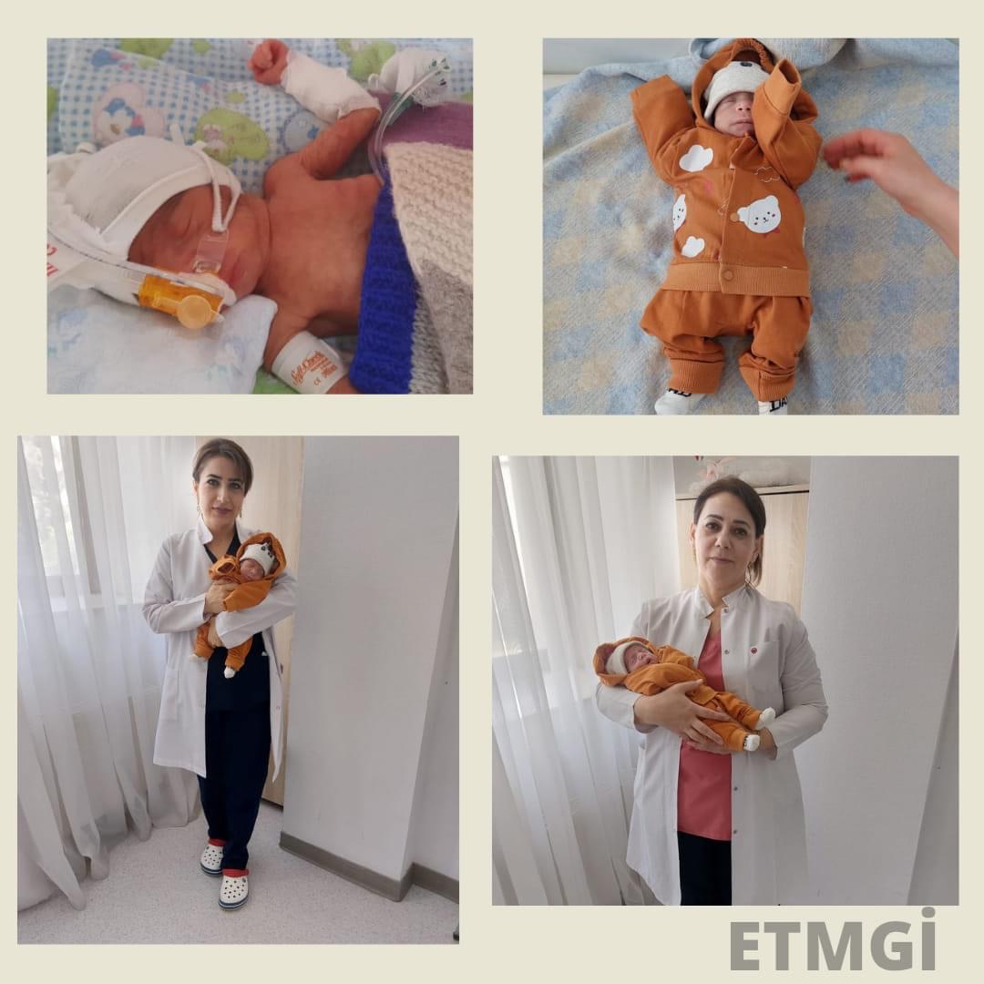 Hamiləliyin 26-cı həftəsində 1 000 qram çəkidə dünyaya gələn körpə evə yola salınıb - ETMGİ