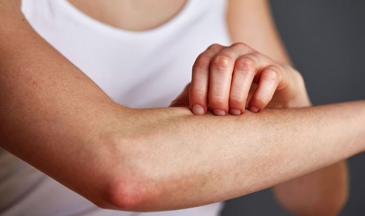 Bu əlamətlər orqanizmdə B12 vitamini çatışmazlığının olduğunu göstərir 
