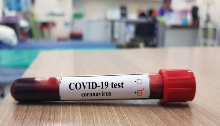 Daha 9 nəfər koronavirusa yoluxub