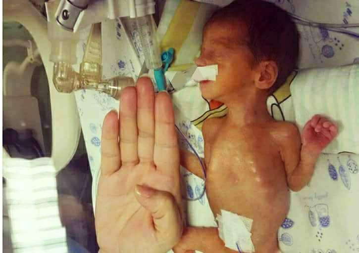 20 il sonsuzluqdan sonra doğulmuş körpə ağır günləri geridə qoyub - Mərkəzi Klinika