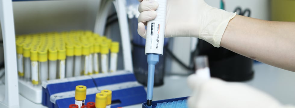 İsveç alimləri yeni növ koronavirus aşkar edib