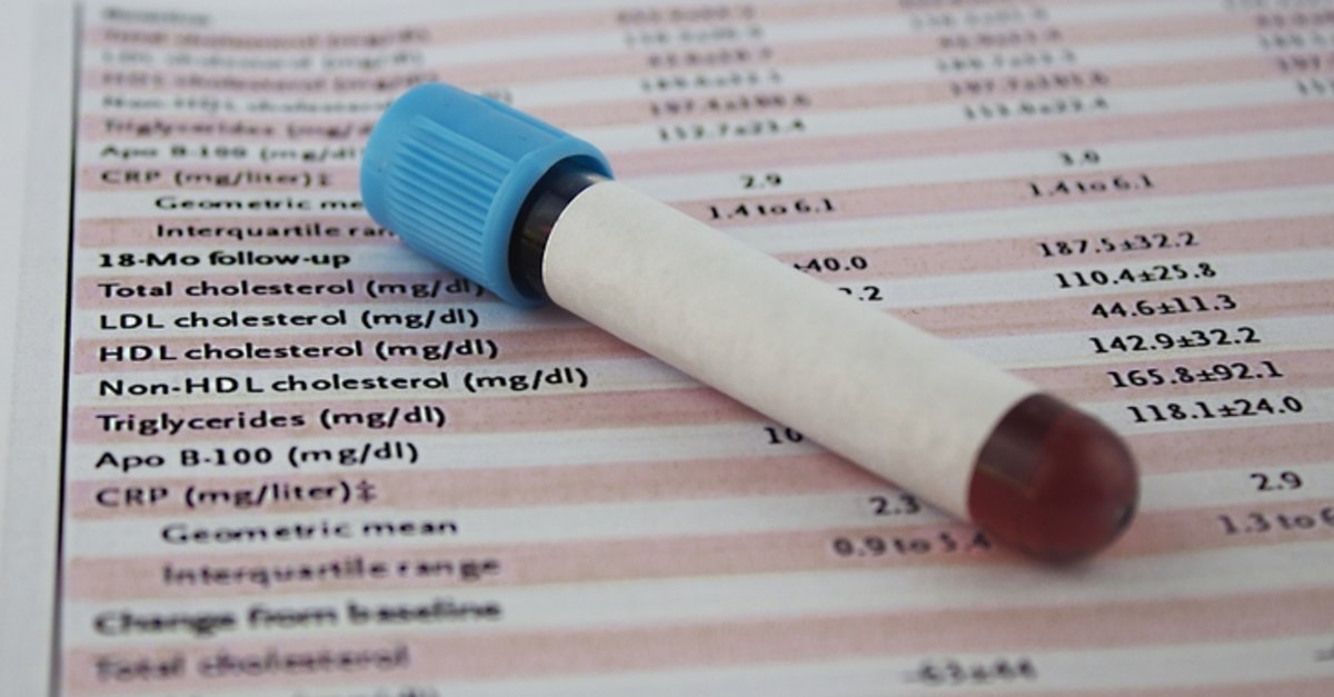Leptin hormonu artıq çəki problemini yaradan əsas səbəblərdən biridir