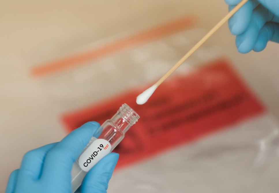 Azərbaycanda koronavirusa yoluxma ilə bağlı icra olunan test sayı 7 milyonu keçib