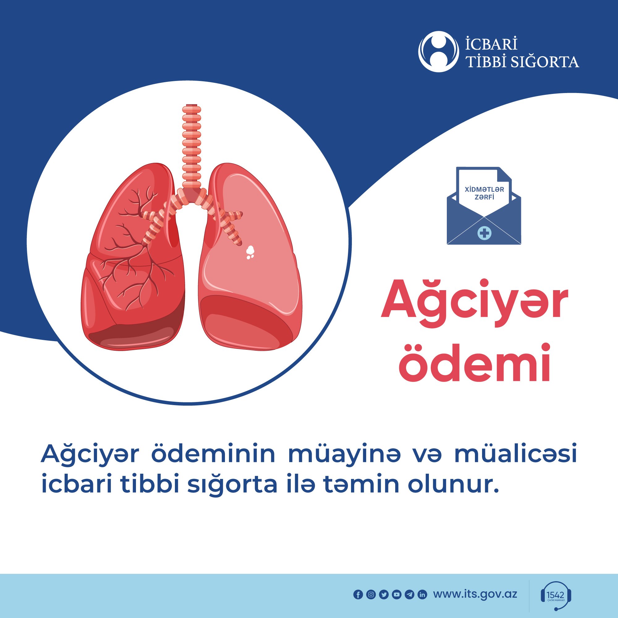 Ağciyər ödeminin müayinə və müalicəsi vətəndaşlara ödənişsiz təqdim edilir