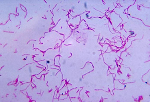 Yeni virus növü diş ətlərinin iltihabını sağaltmağa və xərçəngdən müdafiəyə kömək edəcək
