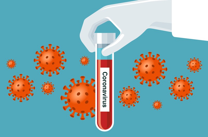 Azərbaycanda koronavirus ilə bağlı son vəziyyət açıqlandı