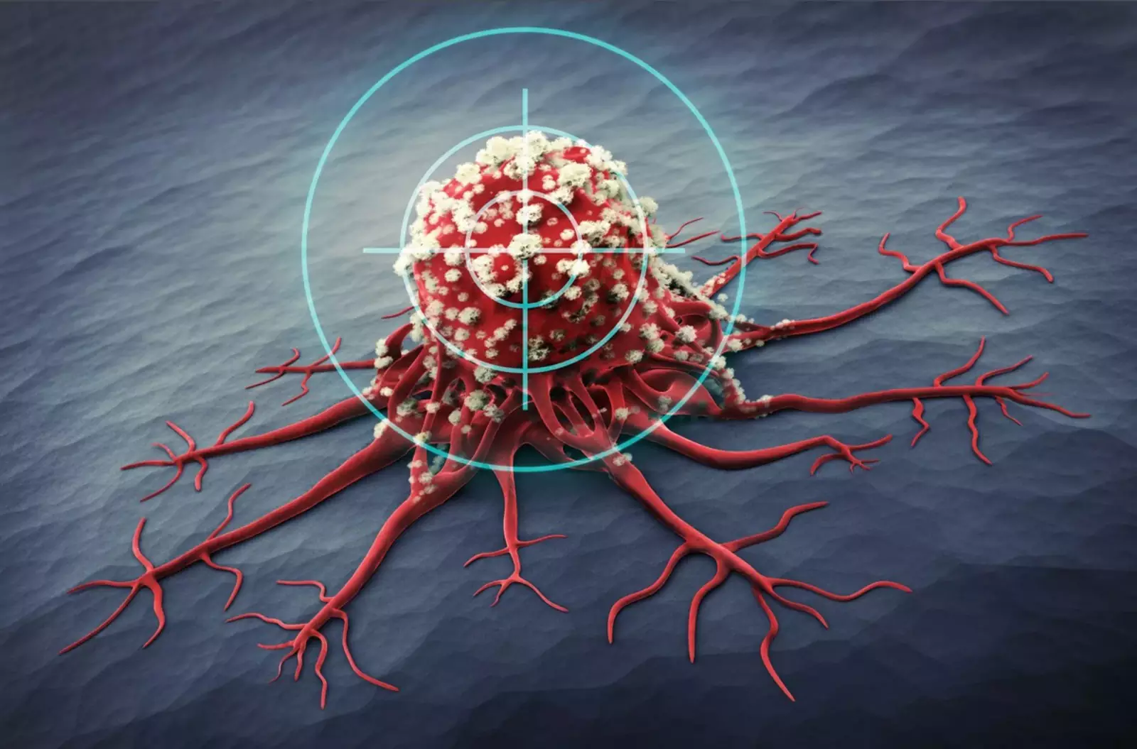 Xərçəng xəstəliyi şişlərinin məhvi üçün radioaktiv gel hazırlanıb  