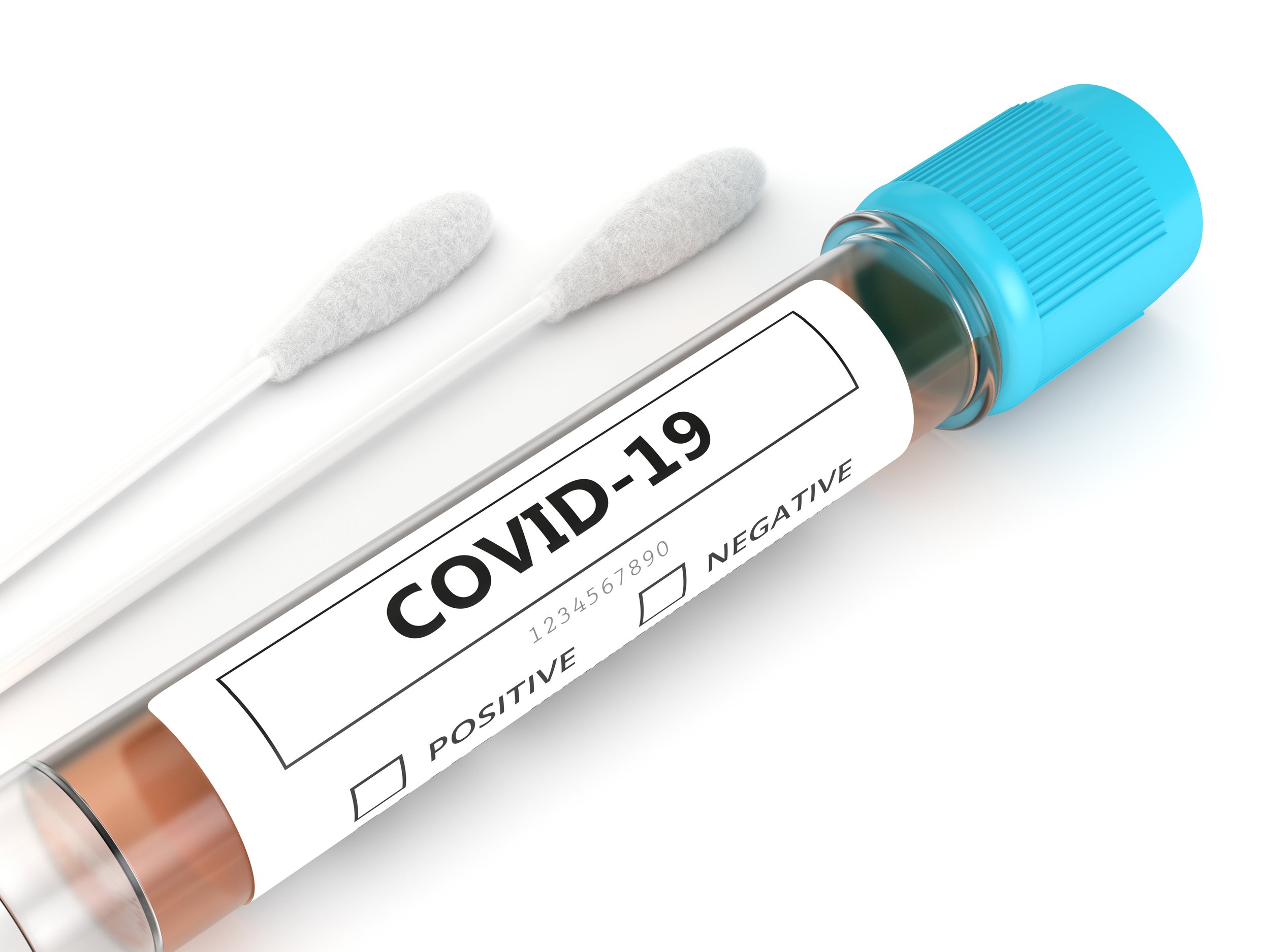 Son sutkada 31 nəfər koronavirusa yoluxub
