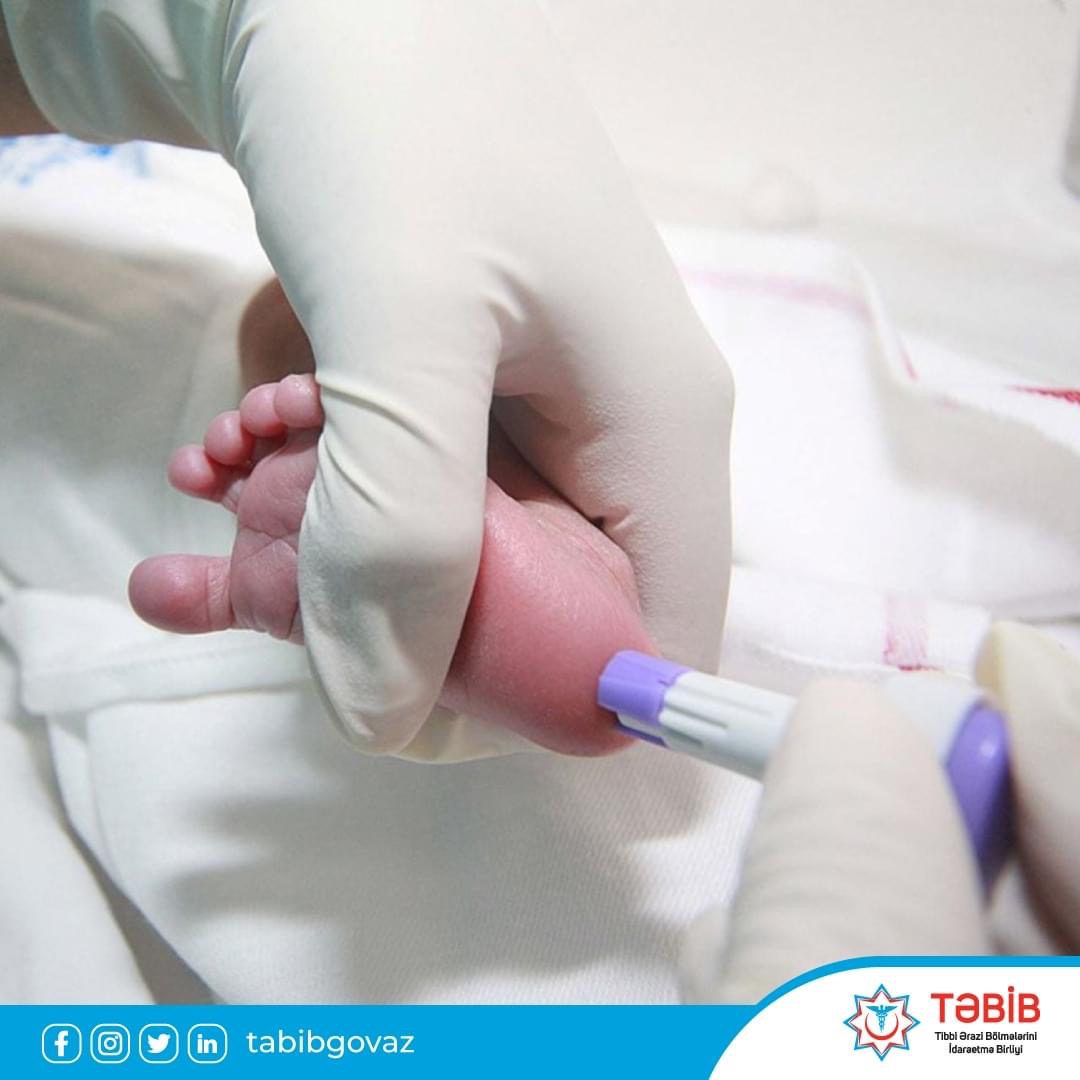 Doğum evlərində ödənişsiz olaraq yeni doğulanlardan topuq testi nümunələri götürülür