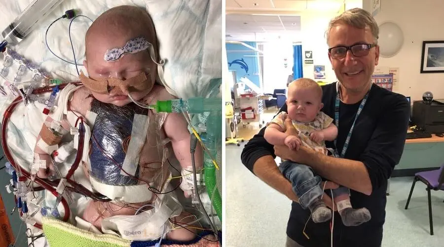 İngiltərədə İLK! - Ürək xəstəliyi olan körpə kök hüceyrə müalicəsi ilə sağlamlığına qovuşub