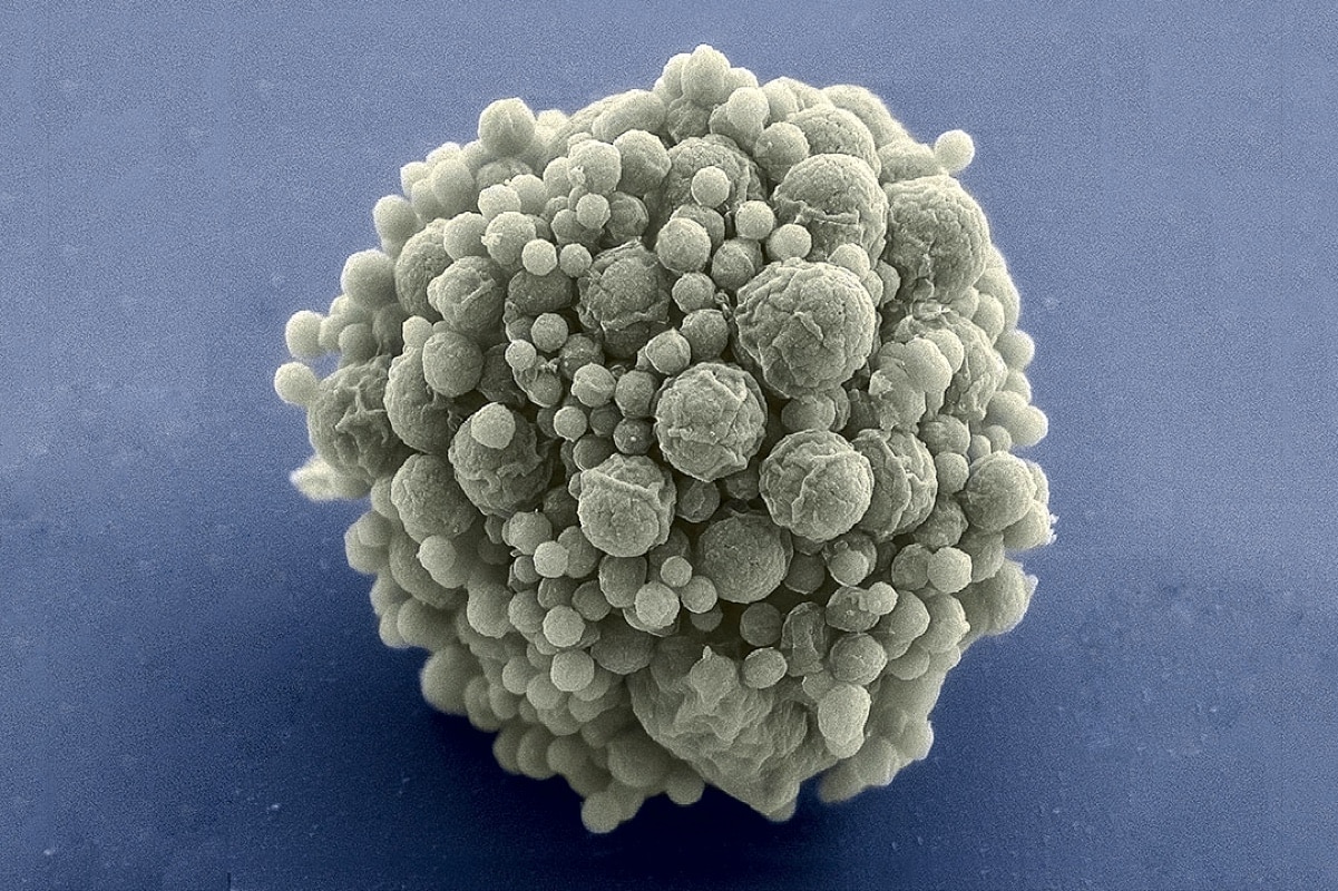 Planetdə hərəkət edən ən kiçik varlıq - süni bakteriya yaradılıb