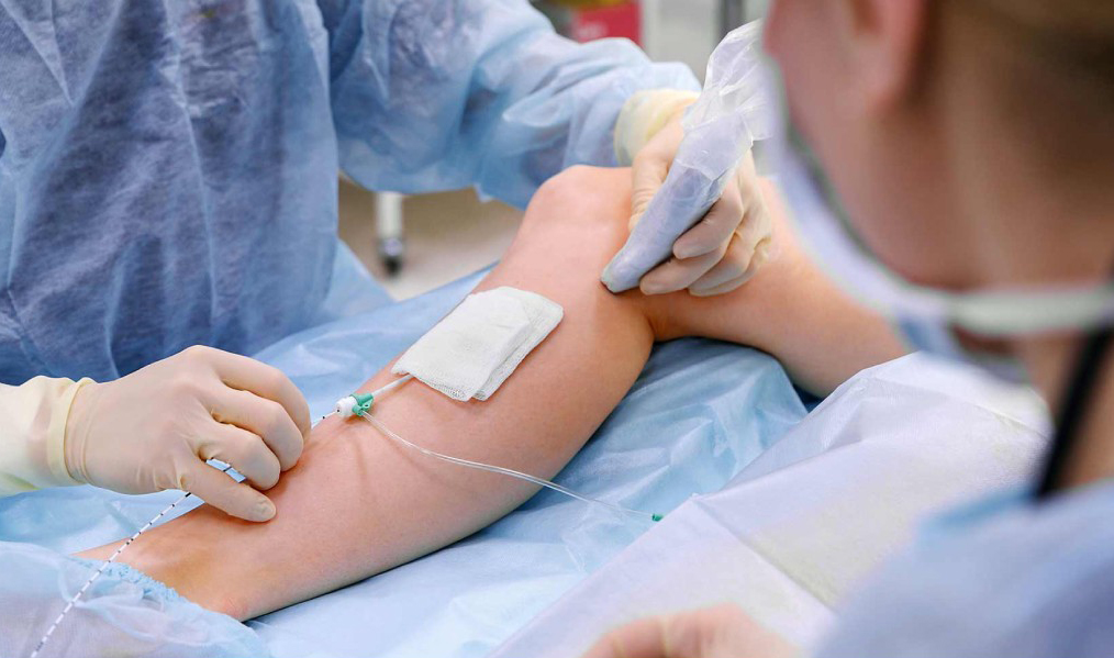 Varikozun ən müasir müalicə üsulu - Endovenoz Lazer Ablasiya