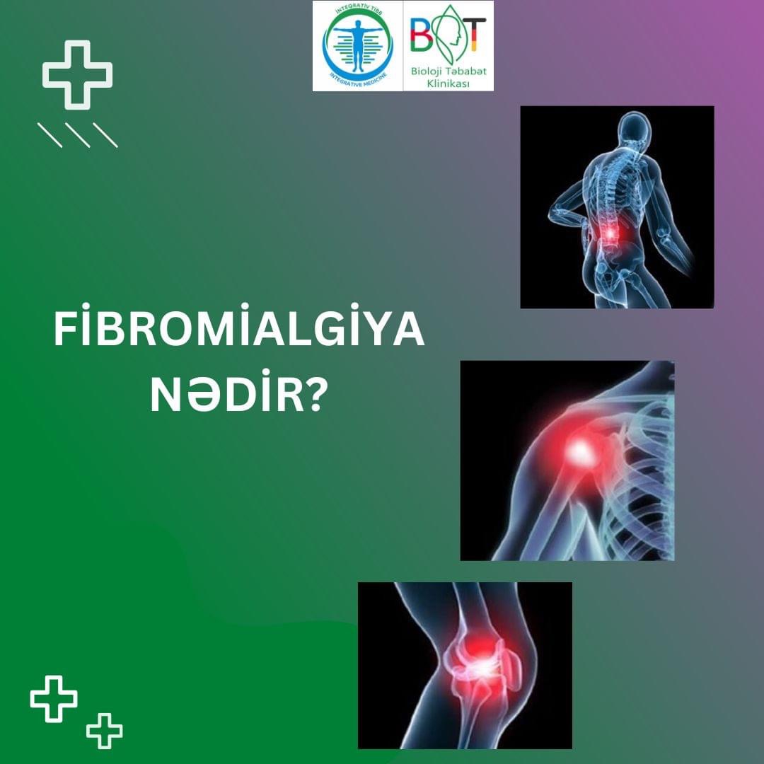Fibromialgiyanın simptomları nədir?