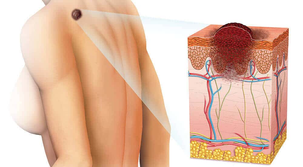 Alimlərdən mühüm kəşf: Genlər aşkarlandı