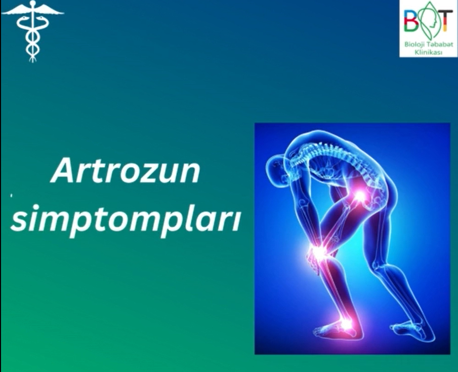 Artrozun yaranma səbəbləri və simptomları     