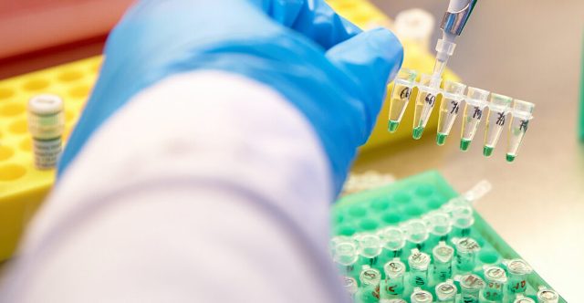 Uzaq Şərq Federal Universiteti: Ölümcül genetik xəstəliyin diaqnozu üçün yeni üsul müəyyən etdik