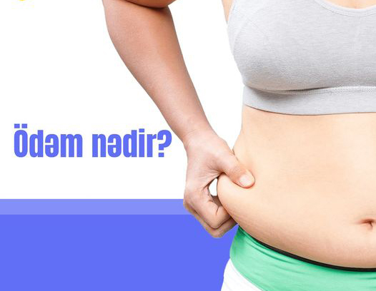 Ödəm nədir?
