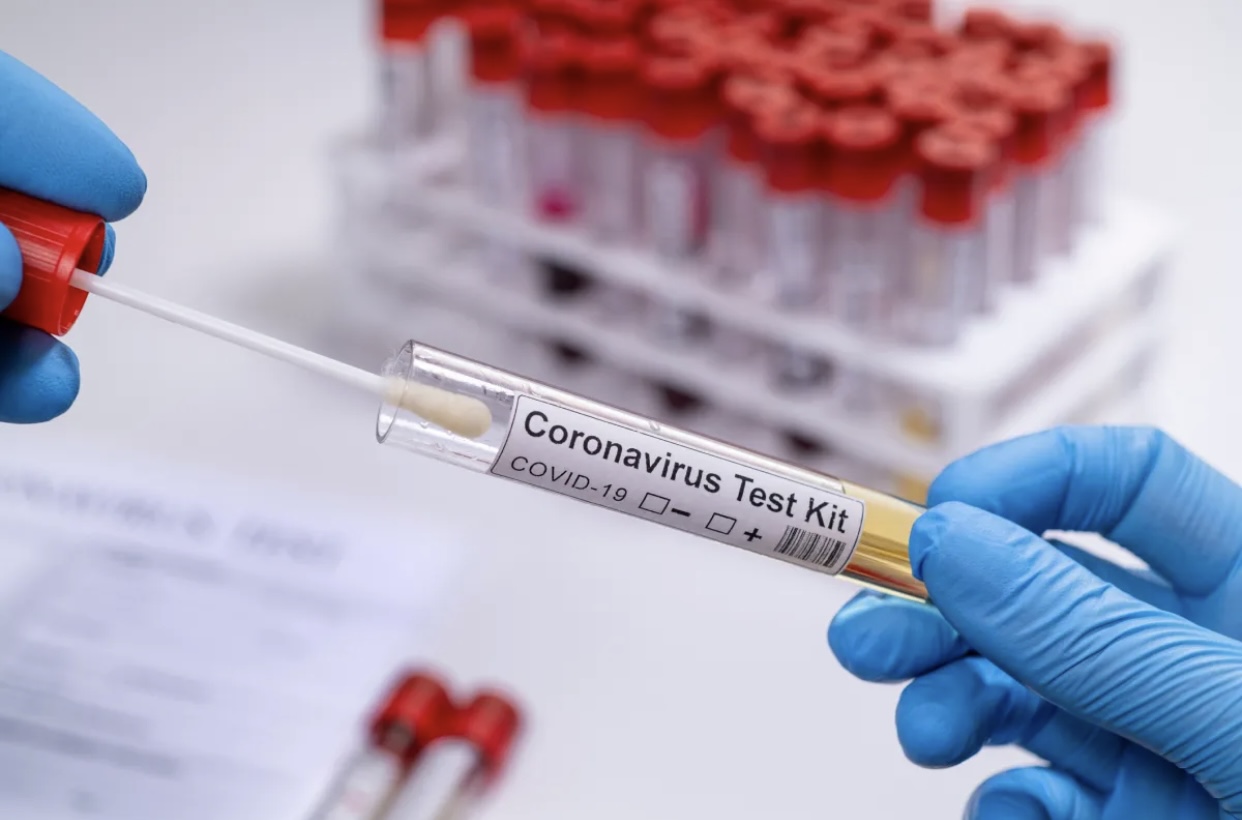 35 nəfər koronavirusa yoluxub, 5 nəfər vəfat edib