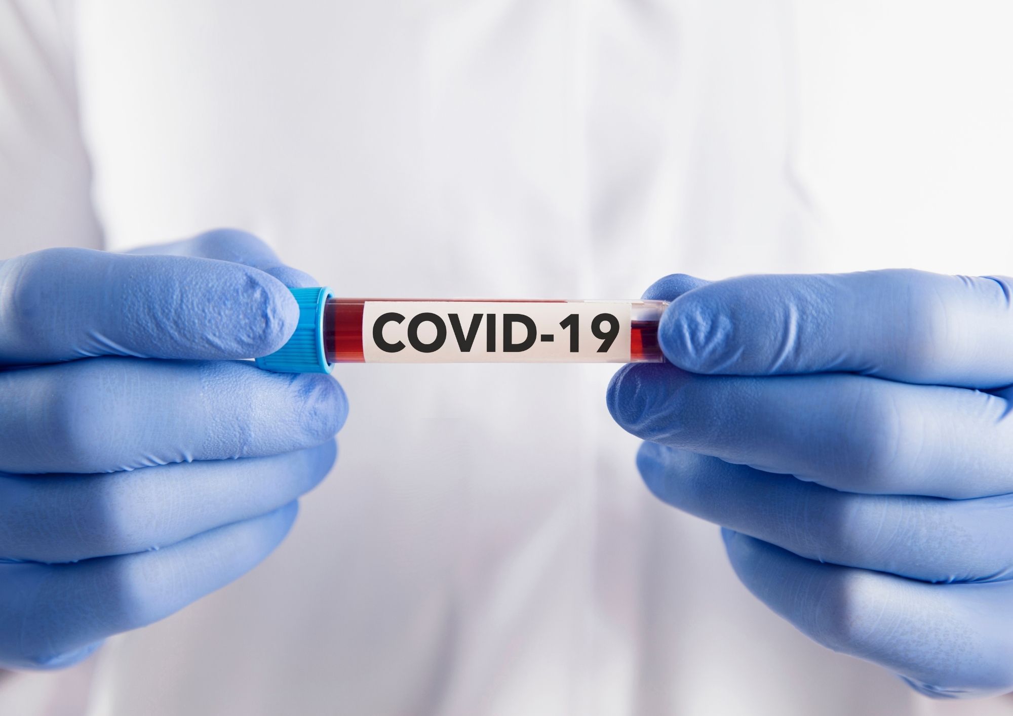 Daha 33 nəfər koronavirusa yoluxub