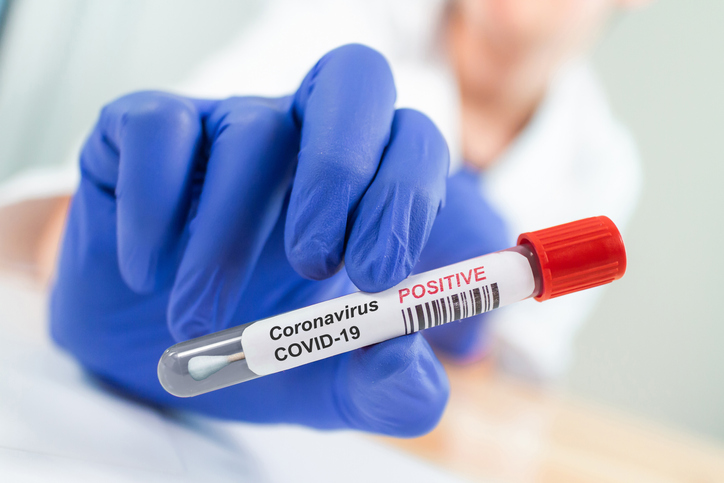 Daha 17 nəfər koronavirusa yoluxub