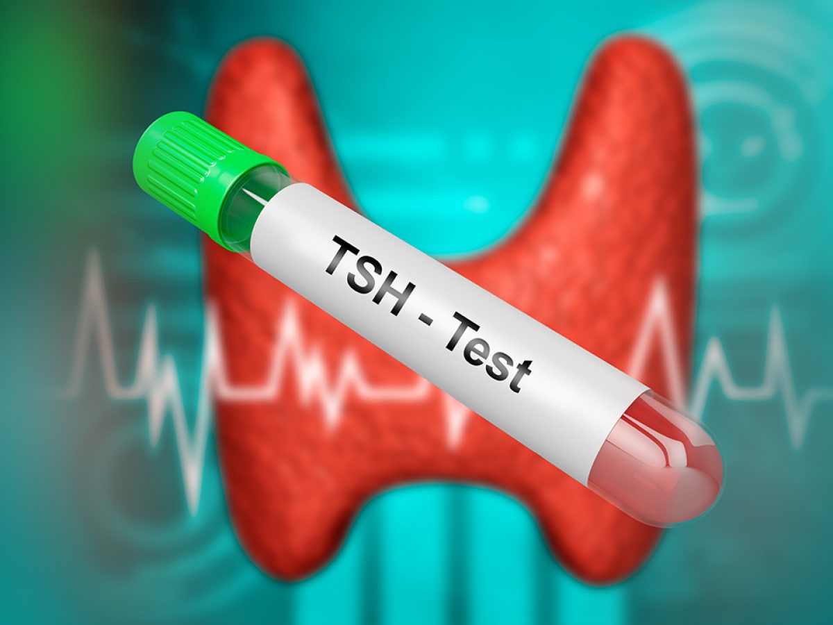 TSH reseptorlarına qarşı anticisimlər testi bir sıra xəstəliklərin diaqnostikasında tətbiq olunur
