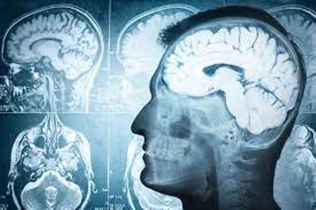 Neyroloqlar: İnsan beyni 30-40 yaşa qədər inkişaf edir