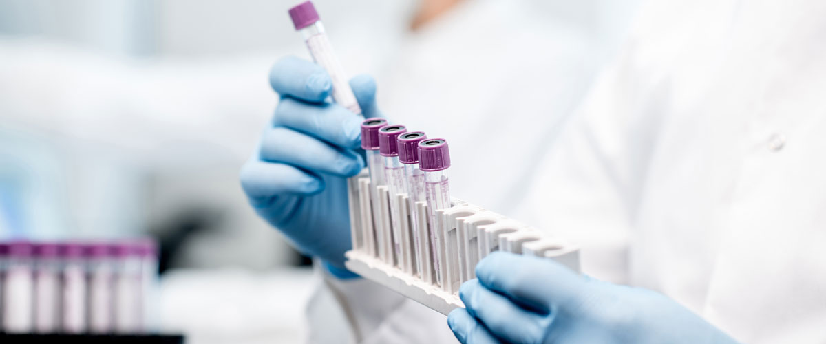 Laborator analizlərin nəticələrinə onlayn baxmaq mümkündürmü? - 