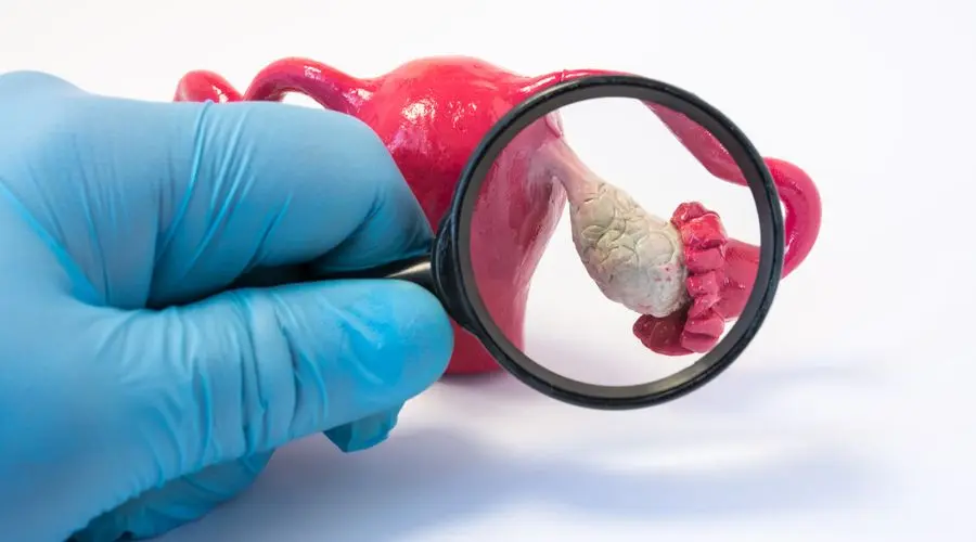 Gənc yaşda yumurtalıqların çıxarılması Parkinson riskini artıra bilər