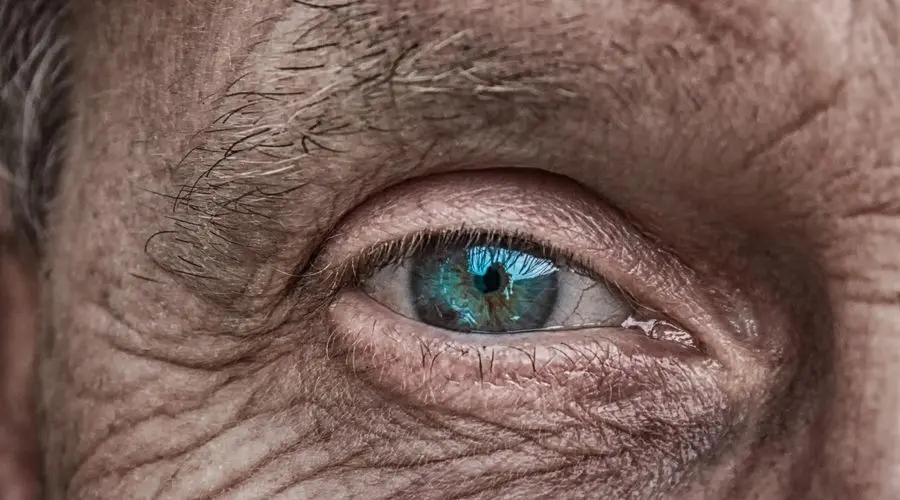 Gözlərdə Alzheimerin ilk əlamətləri