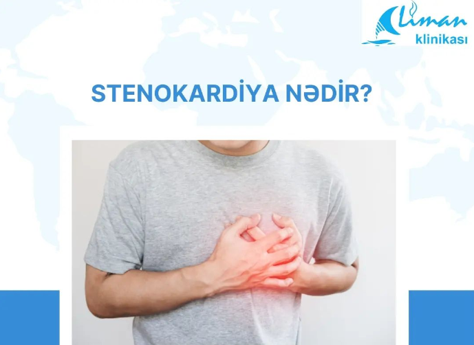 Stenokardiya nədir? Səbəbləri, risk faktorları