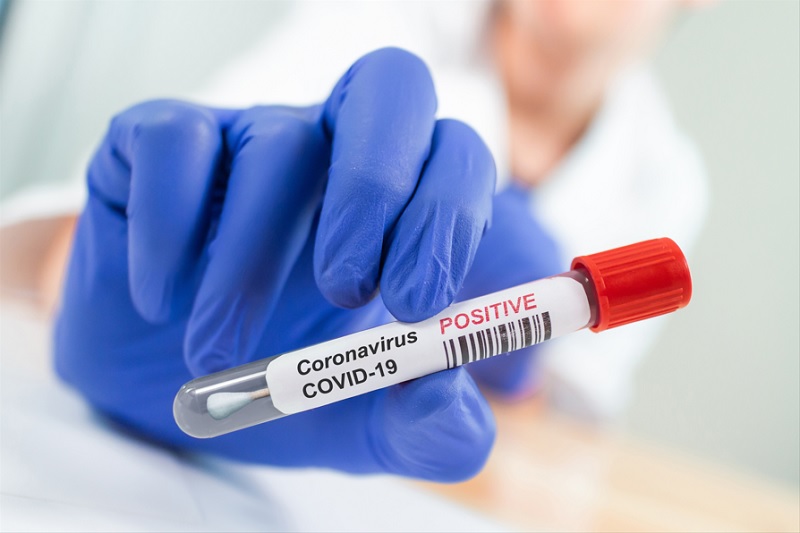 Daha 10 nəfər koronavirusa yoluxub