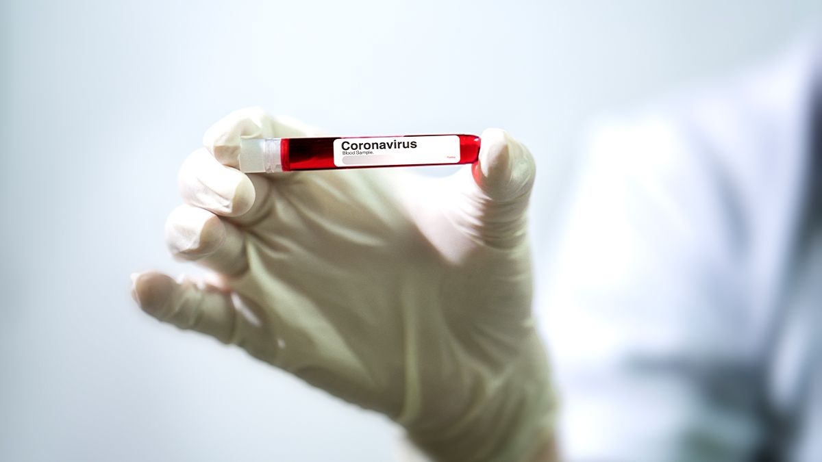 Son sutkada 4 nəfər koronavirusdan ölüb