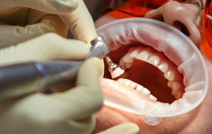 Dişlərin zədələnməsinin əsas səbəbləri hansılardır?