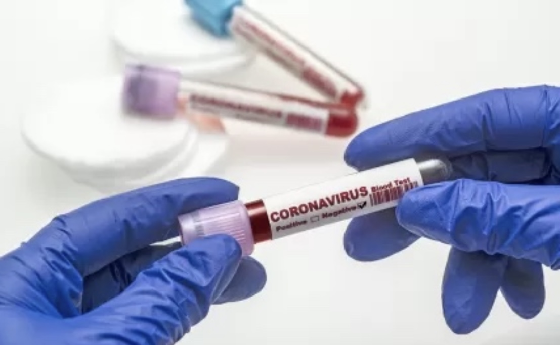 Daha 15 nəfər koronavirusa yoluxub
