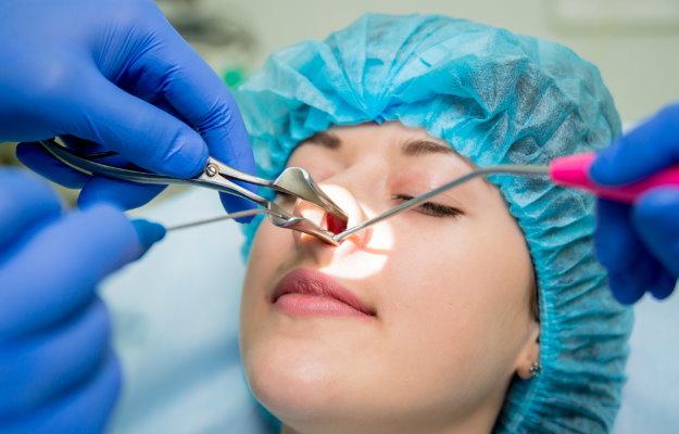 FESC (FESS) əməliyyatı nədir?