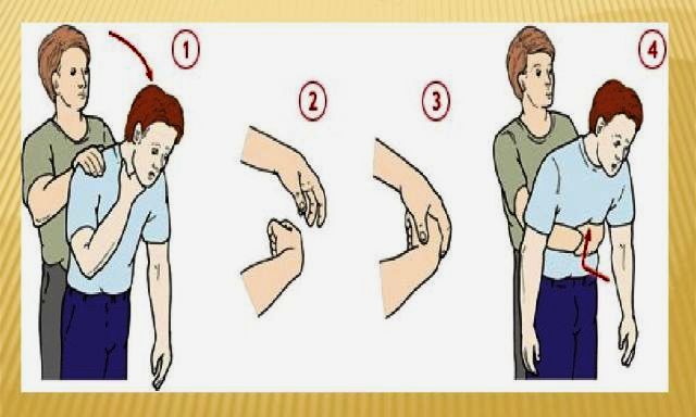 Həkimlər şaftalı tumu udan xəstəni xilas ediblər - Bu hal baş verərsə ilk olaraq nə etməli?