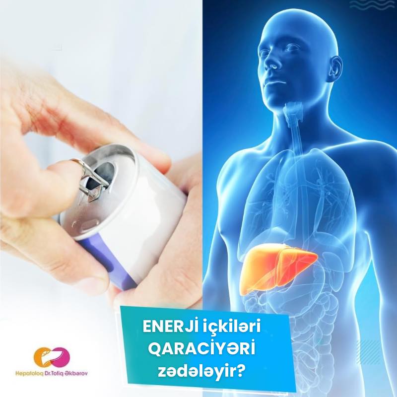  Enerji içkiləri qaraciyəri zədələyir?   