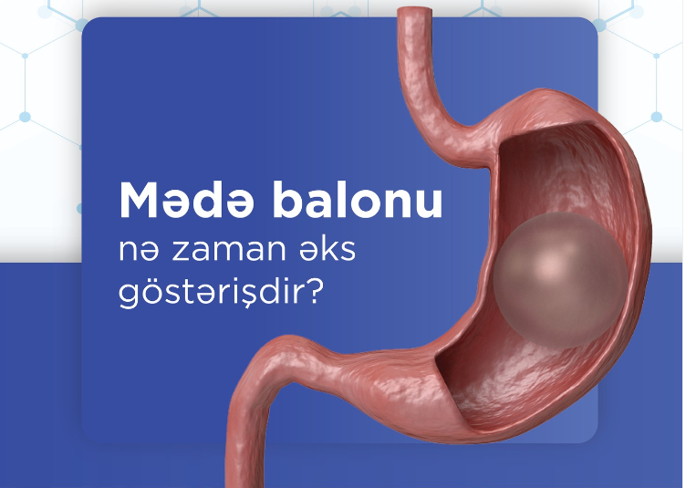Mədə balonu nə zaman əks göstərişdir?